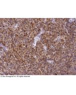 Anti-MUC-1 Antibody, Rabbit Polyclonal sinobiological 12123-T24