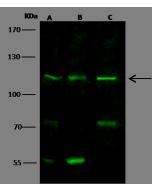 Anti-Desmoglein 1/DSG1 Antibody, Rabbit Polyclonal sinobiological 101147-T32