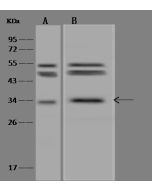 Anti-E2f6 Antibody, Rabbit Polyclonal sinobiological 310180-T32