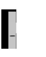 Anti-FAM156A Antibody, Rabbit Polyclonal sinobiological 203058-T36
