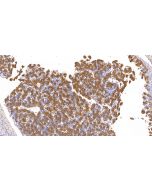Anti-Human AFP/Alpha-fetoprotein Antibody, Mouse MAb sinobiological IHC099