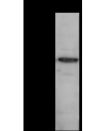 Anti-ACTA2 Antibody, Rabbit Polyclonal sinobiological 100125-T32