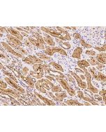 Anti-DDAH1 Antibody, Rabbit Polyclonal sinobiological 102610-T10
