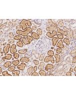 Anti-HSPH1/Hsp105 Antibody, Rabbit Polyclonal sinobiological 200879-T08