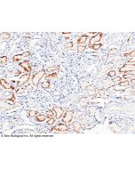 Recombinant Anti-Cystatin C Antibody, Rabbit Monoclonal sinobiological 10439-R033