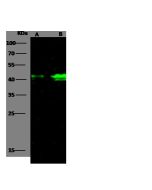 Anti-Langerin/CD207 Antibody, Rabbit Polyclonal sinobiological 100414-T32