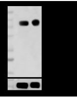 Phospho-EGF Receptor (Thr669, Thr693) Antibody, Rabbit MAb sinobiological 111676-R0016