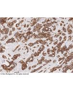 Anti-Cytokeratin 7/KRT7 Antibody, Mouse Monoclonal sinobiological 100310-MM02