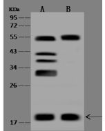 Anti-BUD31 Antibody, Rabbit Polyclonal sinobiological 201438-T36