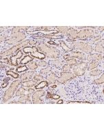 Anti-METTL9 Antibody, Rabbit Polyclonal sinobiological 204550-T08