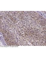 Anti-GGCT Antibody, Rabbit Polyclonal sinobiological 14366-T60