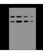Anti-ASS1 Antibody, Rabbit Polyclonal sinobiological 200448-T44