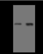 Anti-EphA7 Antibody, Rabbit Polyclonal sinobiological 310442-T32