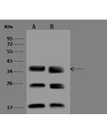 Anti-CNPY3 Antibody, Rabbit Polyclonal sinobiological 203900-T44