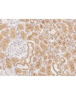 Anti-CEACAM16 Antibody, Rabbit Polyclonal sinobiological 208766-T08