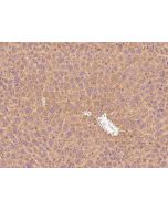 Anti-Factor IX Antibody, Rabbit Polyclonal sinobiological 50362-T24