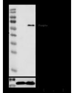 Phospho-SMAD2 (Ser465, 467) Antibody, Rabbit MAb sinobiological 110472-R0010