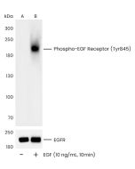 Phospho-EGF Receptor (Tyr845) Antibody, Rabbit MAb sinobiological 110828-R0007