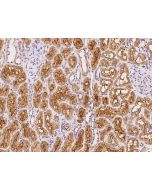 Anti-DNAJC12 Antibody, Rabbit Polyclonal sinobiological 201954-T08