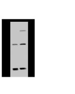 Anti-ADAT3 Antibody, Rabbit Polyclonal sinobiological 102768-T40