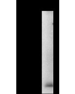 Anti-FHIT Antibody, Rabbit Polyclonal sinobiological 310358-T40