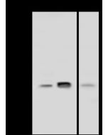 Anti-Bcl-2 Antibody, Rabbit Polyclonal sinobiological 202274-T36