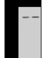 Anti-Cytokeratin 8 Antibody, Rabbit Polyclonal sinobiological 100583-T44