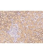 Anti-C17orf99 Antibody, Rabbit Polyclonal sinobiological 206145-T08