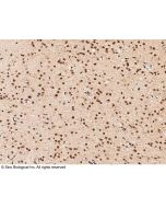Anti-Dppa2 Antibody, Rabbit Polyclonal sinobiological 100950-T10