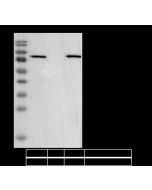 Phospho-PKCα (Thr638) Antibody, Rabbit MAb sinobiological 111172-R0049