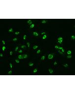 Anti-GMEB1 Antibody, Rabbit Polyclonal sinobiological 200567-T02