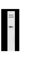 Anti-CLN8 Antibody, Rabbit Polyclonal sinobiological 107033-T32