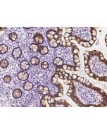 Anti-Cytokeratin 20/KRT20 Antibody, Rabbit Polyclonal sinobiological 201092-T08