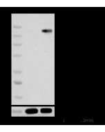 Phospho-VEGF Receptor 2 (Tyr1175) Antibody, Rabbit MAb sinobiological 111431-R0010