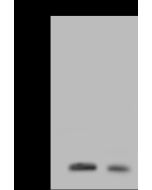 Anti-AGR2 Antibody, Rabbit Polyclonal sinobiological 100694-T36