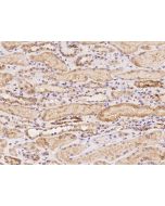 Anti-C5orf22 Antibody, Rabbit Polyclonal sinobiological 205107-T08