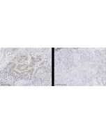 Recombinant Phospho-AKT (Ser473) Antibody, Rabbit Monoclonal sinobiological 110591-R0113