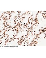 Anti-NBL1 Antibody, Rabbit Polyclonal sinobiological 10169-RP02
