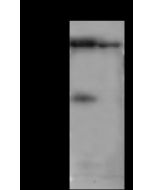 Anti-DPP6 Antibody, Rabbit Polyclonal sinobiological 100592-T36