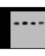 Anti-DDX46 Antibody, Rabbit Polyclonal sinobiological 203515-T36