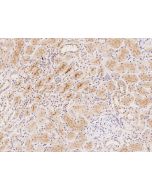 Anti-C17orf105 Antibody, Rabbit Polyclonal sinobiological 206087-T08