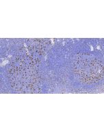 Anti-Human CD68 Antibody, Mouse MAb sinobiological IHC017