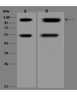 Anti-DGCR8 Antibody, Rabbit Polyclonal sinobiological 204013-T42