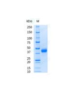 Recombinant Cynomolgus CD3 epsilon/CD3e Protein (ECD, hFc Tag), HPLC-verified, Endotoxin-Free sinobiological 90857-C02H-UE