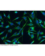 Anti-HABP1/C1QBP/gC1qR Antibody, Mouse Monoclonal sinobiological 11874-MM09