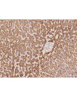 Anti-ACSS3 Antibody, Rabbit Polyclonal sinobiological 203509-T08