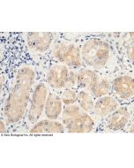 Anti-Leptin Antibody, Rabbit Polyclonal sinobiological 10221-RP02