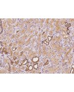 Anti-C9orf100/ARHGEF39 Antibody, Rabbit Polyclonal sinobiological 201965-T08