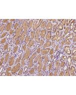 Anti-ARG2/Arginase II Antibody, Rabbit Polyclonal sinobiological 203532-T08