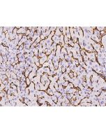 Recombinant Anti-CD36 Antibody, Rabbit Monoclonal sinobiological 10752-R331
